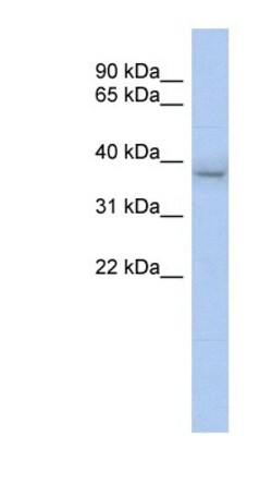 KLHDC8B Antibody, Novus Biologicals 100&mu;L; Unlabeled:Antibodies, Polyclonal