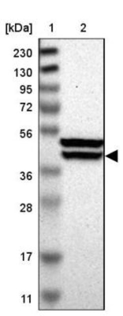 KLHDC8B Antibody, Novus Biologicals 0.1mL; Unlabeled:Antibodies, Polyclonal
