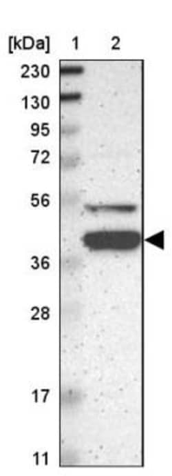 KLHDC8B Antibody, Novus Biologicals 0.1 mL | Buy Online | Novus Biologicals | Fisher Scientific