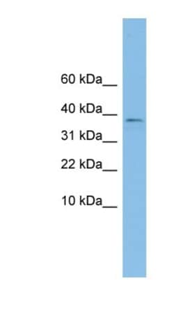 KLHDC9 Antibody, Novus Biologicals 100 &mu;L | Buy Online | Novus Biologicals | Fisher Scientific