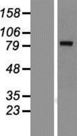 Novus Biologicals&trade;&nbsp;KLHL1 Overexpression Lysate