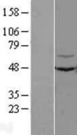 Novus Biologicals™ KLHL12/C3IP1 Overexpression Lysate