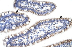 KLHL13 Antibody, Novus Biologicals 100&mu;L; Unlabeled:Antibodies, Polyclonal