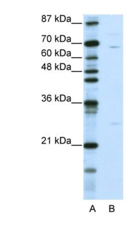 KLHL13 Antibody, Novus Biologicals 100&mu;L; Unlabeled:Antibodies, Polyclonal