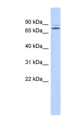 KLHL14 Antibody, Novus Biologicals 100&mu;L; Unlabeled:Antibodies, Polyclonal