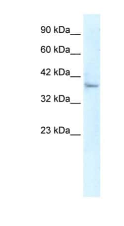 KLHL14 Antibody, Novus Biologicals 100&mu;L; Unlabeled:Antibodies, Polyclonal