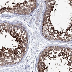 KLHL17 Antibody, Novus Biologicals:Antibodies:Primary Antibodies