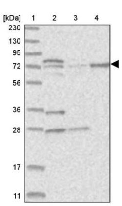 KLHL17 Antibody, Novus Biologicals:Antibodies:Primary Antibodies