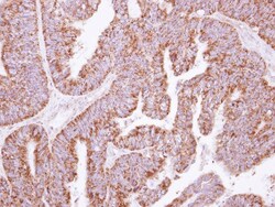 KLHL2 Antibody, Novus Biologicals 0.1mL; Unlabeled:Antibodies, Polyclonal