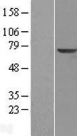 Novus Biologicals&trade;&nbsp;KLHL2 Overexpression Lysate