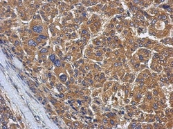 KLHL22 Antibody, Novus Biologicals 0.1mL; Unlabeled:Antibodies, Polyclonal