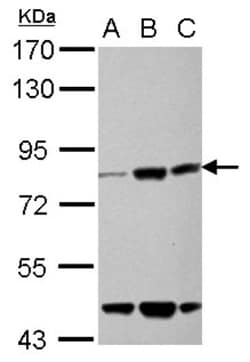 KLHL22 Antibody, Novus Biologicals 0.1mL; Unlabeled:Antibodies, Polyclonal
