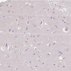 KLHL24 Antibody, Novus Biologicals 0.1mL:Antibodies, Polyclonal