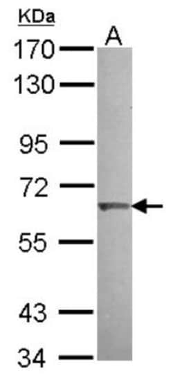KLHL25 Antibody, Novus Biologicals 0.1mL; Unlabeled:Antibodies, Polyclonal