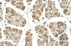 KLHL31 Antibody, Novus Biologicals 100&mu;L; Unlabeled:Antibodies, Polyclonal