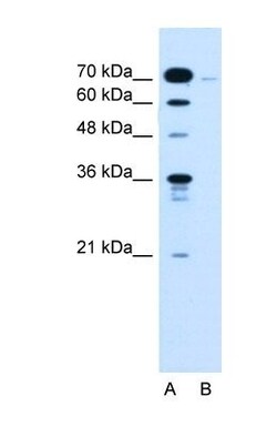 KLHL31 Antibody, Novus Biologicals 100&mu;L; Unlabeled:Antibodies, Polyclonal