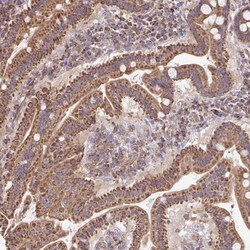 KLHL34 Antibody, Novus Biologicals:Antibodies:Primary Antibodies