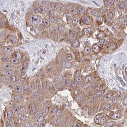 KLHL34 Antibody, Novus Biologicals:Antibodies:Primary Antibodies