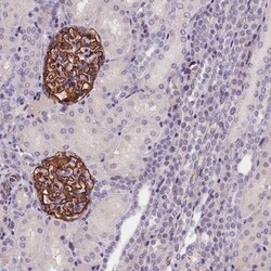 KLHL35 Antibody, Novus Biologicals:Antibodies:Primary Antibodies