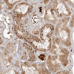 KLHL38 Antibody, Novus Biologicals 0.1mL; Unlabeled:Antibodies, Polyclonal