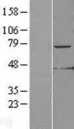 Novus Biologicals™ KLHL6 Overexpression Lysate