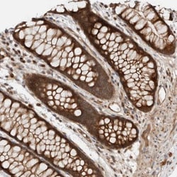 KLHL6 Antibody, Novus Biologicals 0.1mL; Unlabeled:Antibodies, Polyclonal