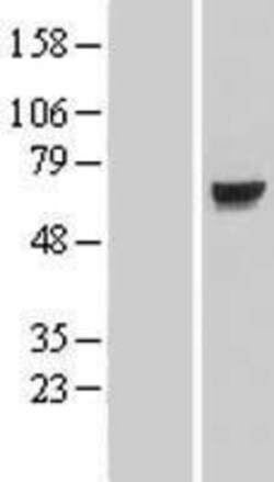 Novus Biologicals&trade;&nbsp;KLHL7 Overexpression Lysate