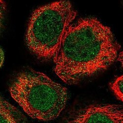 KLHL7 Antibody, Novus Biologicals 25ul | Buy Online | Novus Biologicals | Fisher Scientific