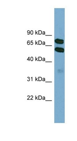 KLHL9 Antibody, Novus Biologicals 20&mu;L; Unlabeled:Antibodies, Polyclonal