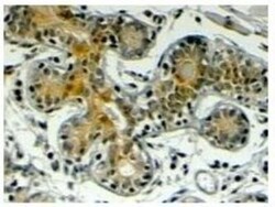 Klotho Antibody, Novus Biologicals 0.1mg; Unlabeled:Antibodies, Polyclonal