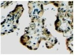Klotho Antibody, Novus Biologicals 0.1mg; Unlabeled:Antibodies, Polyclonal