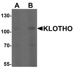 Klotho Antibody - BSA Free, Novus Biologicals 0.1mg; Unlabeled:Antibodies,