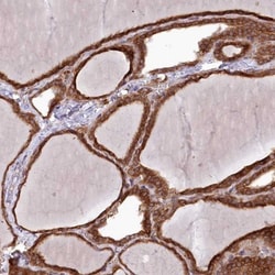 KLRAQ1 Antibody, Novus Biologicals 25 &mu;L; Unlabeled:Antibodies, Polyclonal
