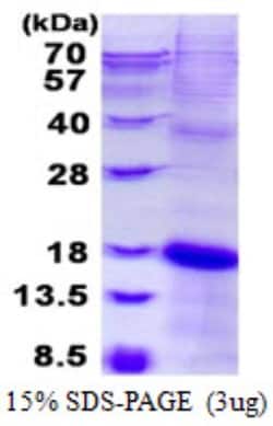 Novus Biologicals&trade;&nbsp;Recombinant Human NKG2C/CD159c/KLRC2 His Protein