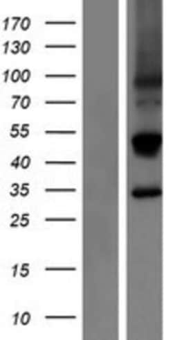 Novus Biologicals&trade;&nbsp;NKG2E/KLRC3 Overexpression Lysate