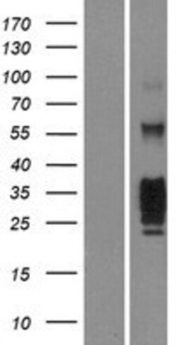 Novus Biologicals&trade;&nbsp;KLRG1 Overexpression Lysate