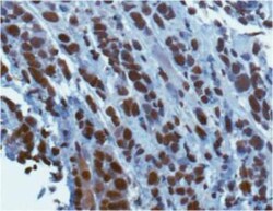 KMT1A/SUV39H1 Antibody, Novus Biologicals 0.1mL; Unlabeled:Antibodies,