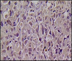 KMT1A/SUV39H1 Antibody, Novus Biologicals 0.1mL; Unlabeled:Antibodies,
