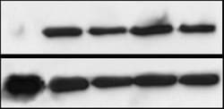 KMT1A/SUV39H1 Antibody, Novus Biologicals 0.1mL; Unlabeled:Antibodies,