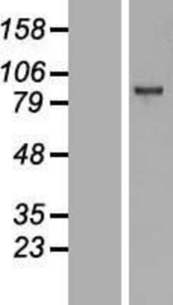 Novus Biologicals&trade;&nbsp;EZH2/KMT6 Overexpression Lysate