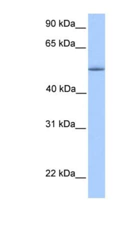 KOX8 Antibody, Novus Biologicals:Antibodies:Primary Antibodies
