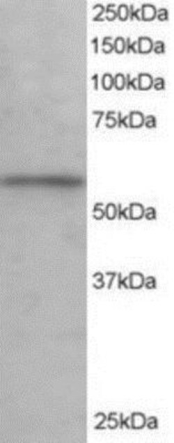 KPNA3 Antibody, Novus Biologicals 0.1mg; Unlabeled:Antibodies, Polyclonal
