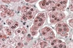 KPNA6 Antibody, Novus Biologicals 0.1mg; Unlabeled:Antibodies, Polyclonal