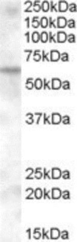 KPNA6 Antibody, Novus Biologicals 0.1mg; Unlabeled:Antibodies, Polyclonal