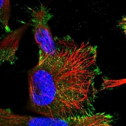 KPRP Antibody, Novus Biologicals 0.1mL; Unlabeled:Antibodies, Polyclonal
