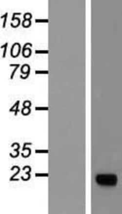 Novus Biologicals&trade;&nbsp;KRAS Overexpression Lysate