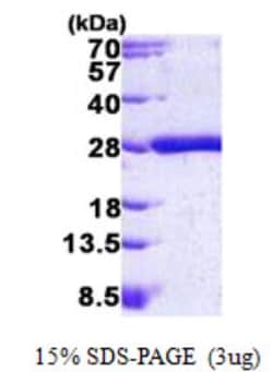 Novus Biologicals Recombinant Human KRAS His Protein 0.1 mg | Buy Online | Novus Biologicals&trade; | Fisher Scientific