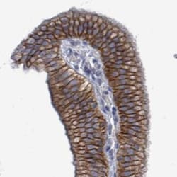 KRAS Antibody, Novus Biologicals:Antibodies:Primary Antibodies