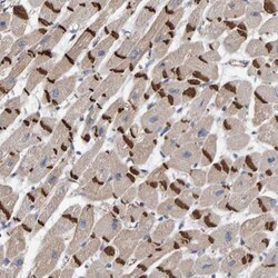 KRBA2 Antibody, Novus Biologicals 0.1mL; Unlabeled:Antibodies, Polyclonal