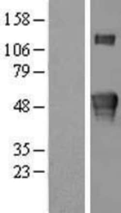 Novus Biologicals™ Kremen-2 Overexpression Lysate